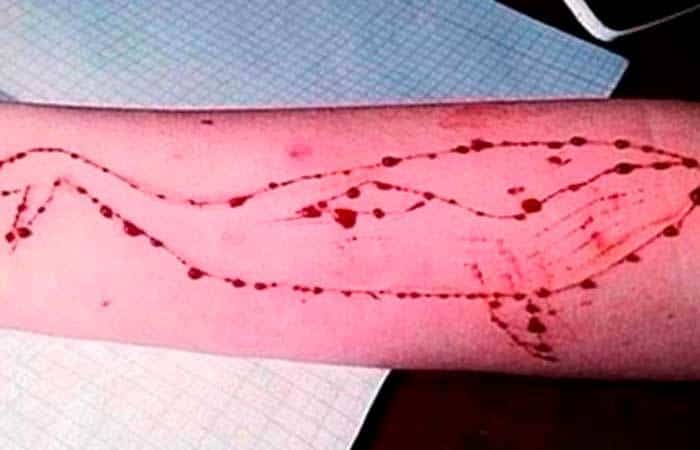 ¿Qué se esconde tras el peligroso juego suicida de la Ballena Azul?