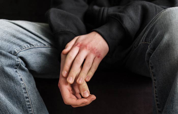 ¿Por qué mi hijo se autolesiona? ¿Es una llamada de atención?